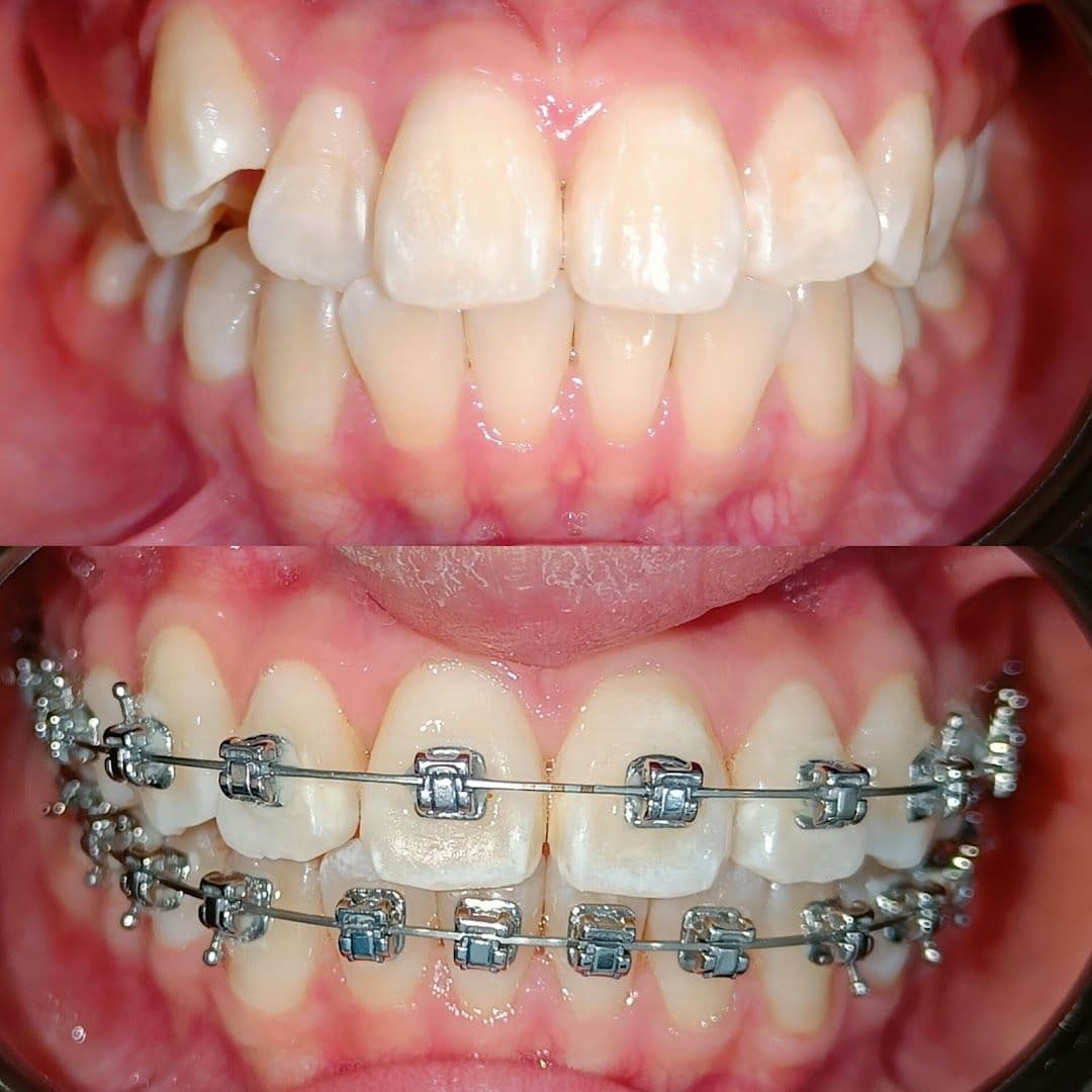 Photo 5 for Smileage Dental Clinic - Taman Danau Desa