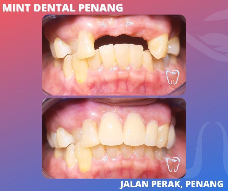 Photo 5 for Mint Dental