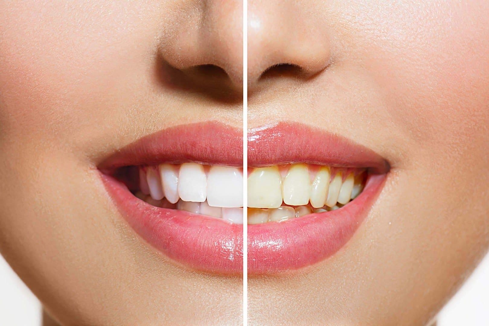 Photo 5 for  Chan Dental Clinic Bandar Baru Klang