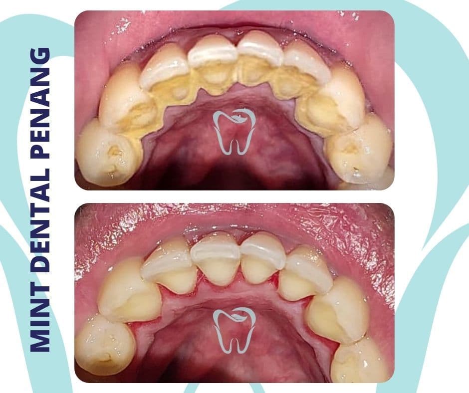 Photo 3 for Mint Dental
