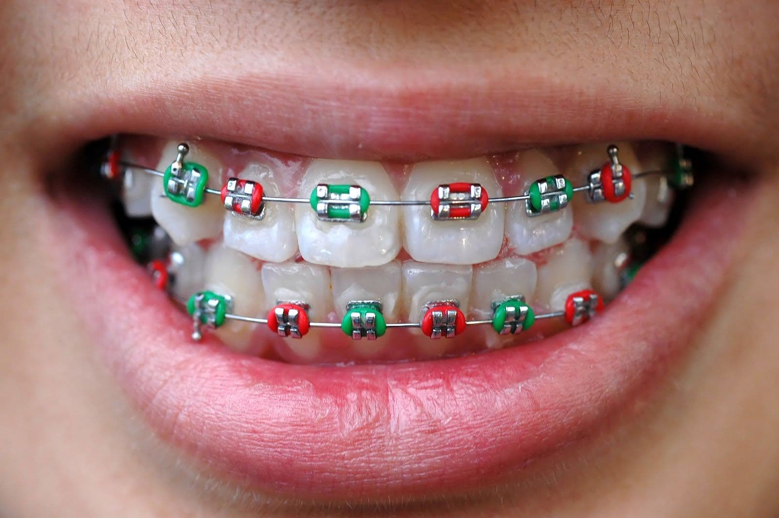 Photo 4 for  Chan Dental Clinic Bandar Baru Klang