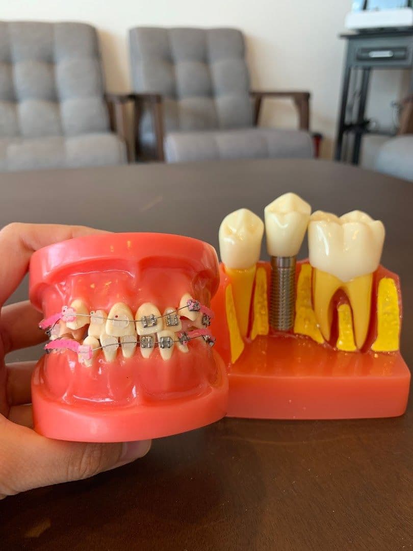 Photo 4 for Drs Wong & Partners Dental Surgeons - Saradise
