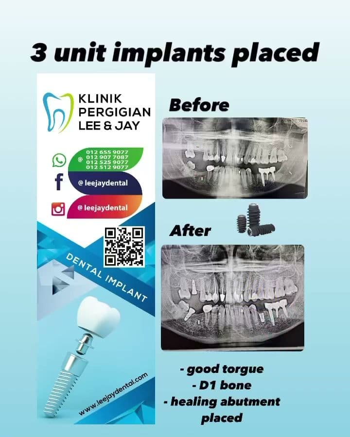 Photo 2 for Klinik Pergigian Lee & Jay